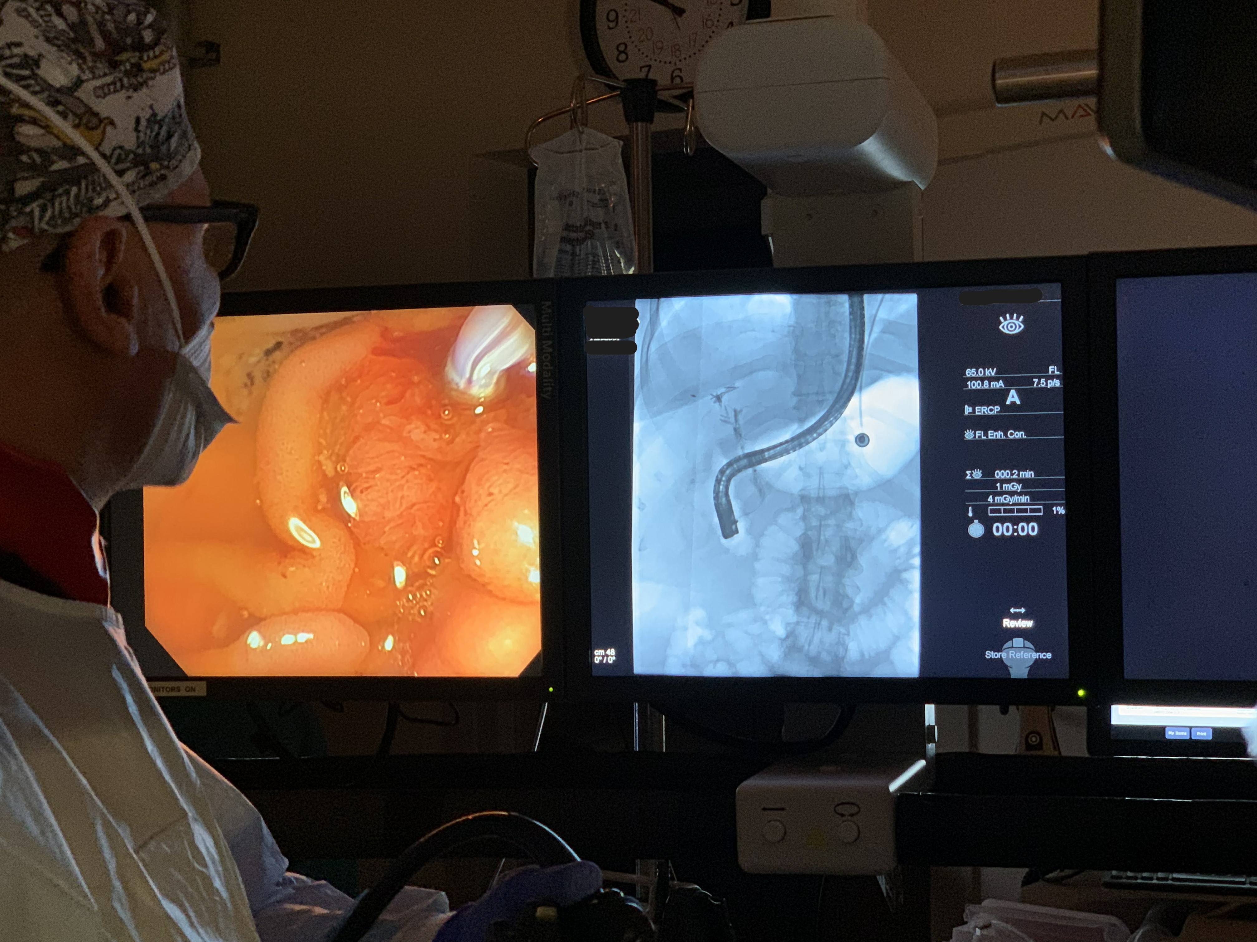 Dr. Todd Baron — ERCP procedure, UNC Advanced Endoscopy Fellowship